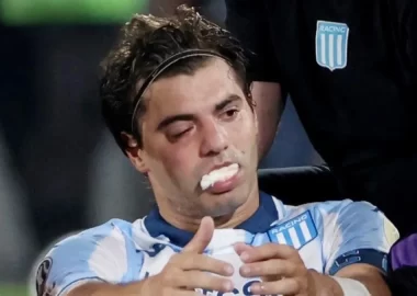 Codazo y susto: el parte medico de Sosa