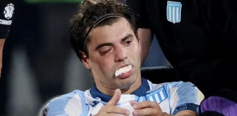 Codazo y susto: el parte medico de Sosa