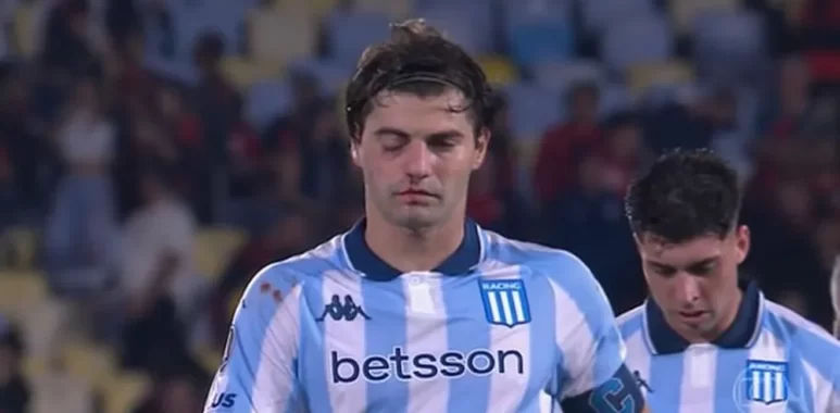 La lesión de Sosa duele más que la derrota